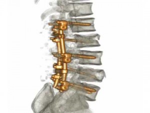 3-back pain-1